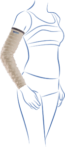 Thuasne manchon Mobiderm standard